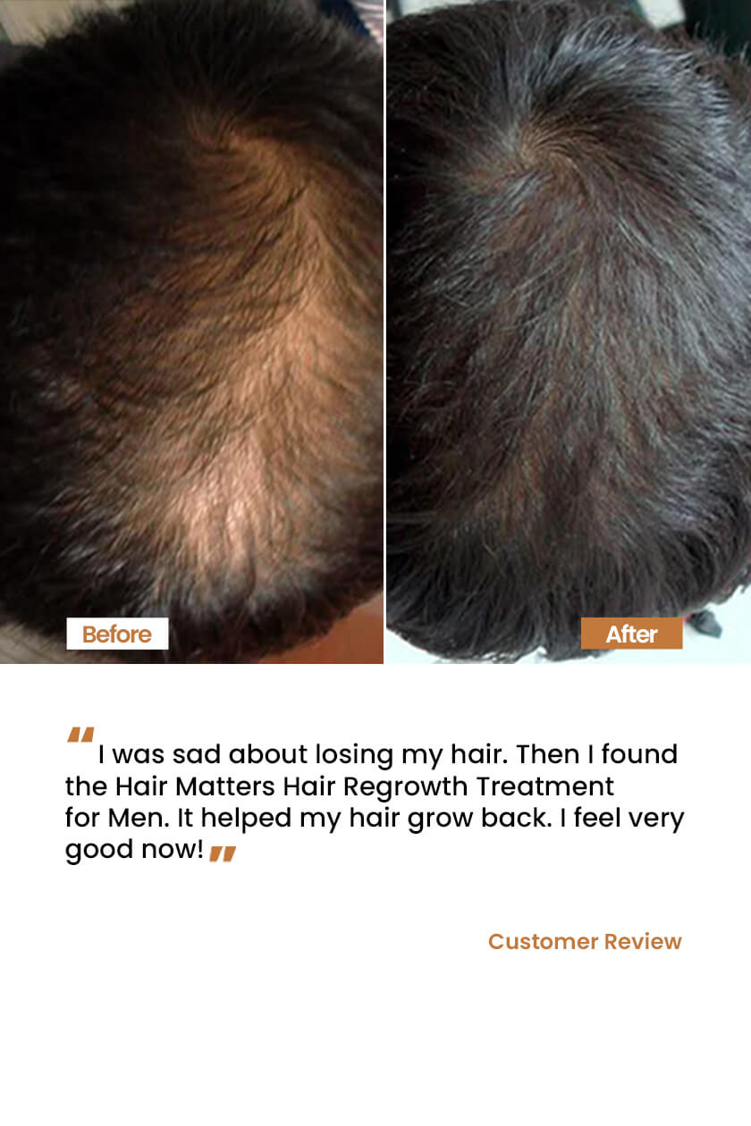 Hair Regrowth Treatment oil for Men