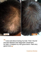 Hair Regrowth Treatment oil for Men