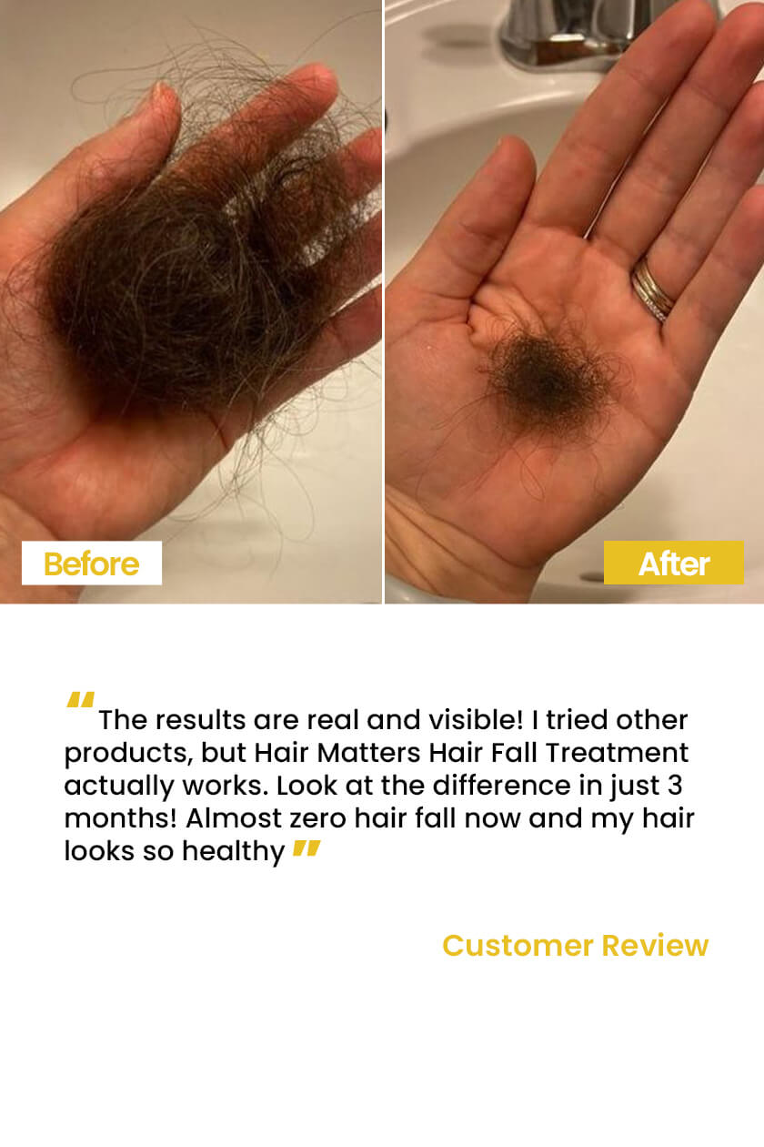 Hair Fall Treatment Oil to Reduce Hair Fall