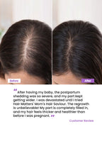 Mom’s Hair Saviour for Reducing Postpartum Hair Fall