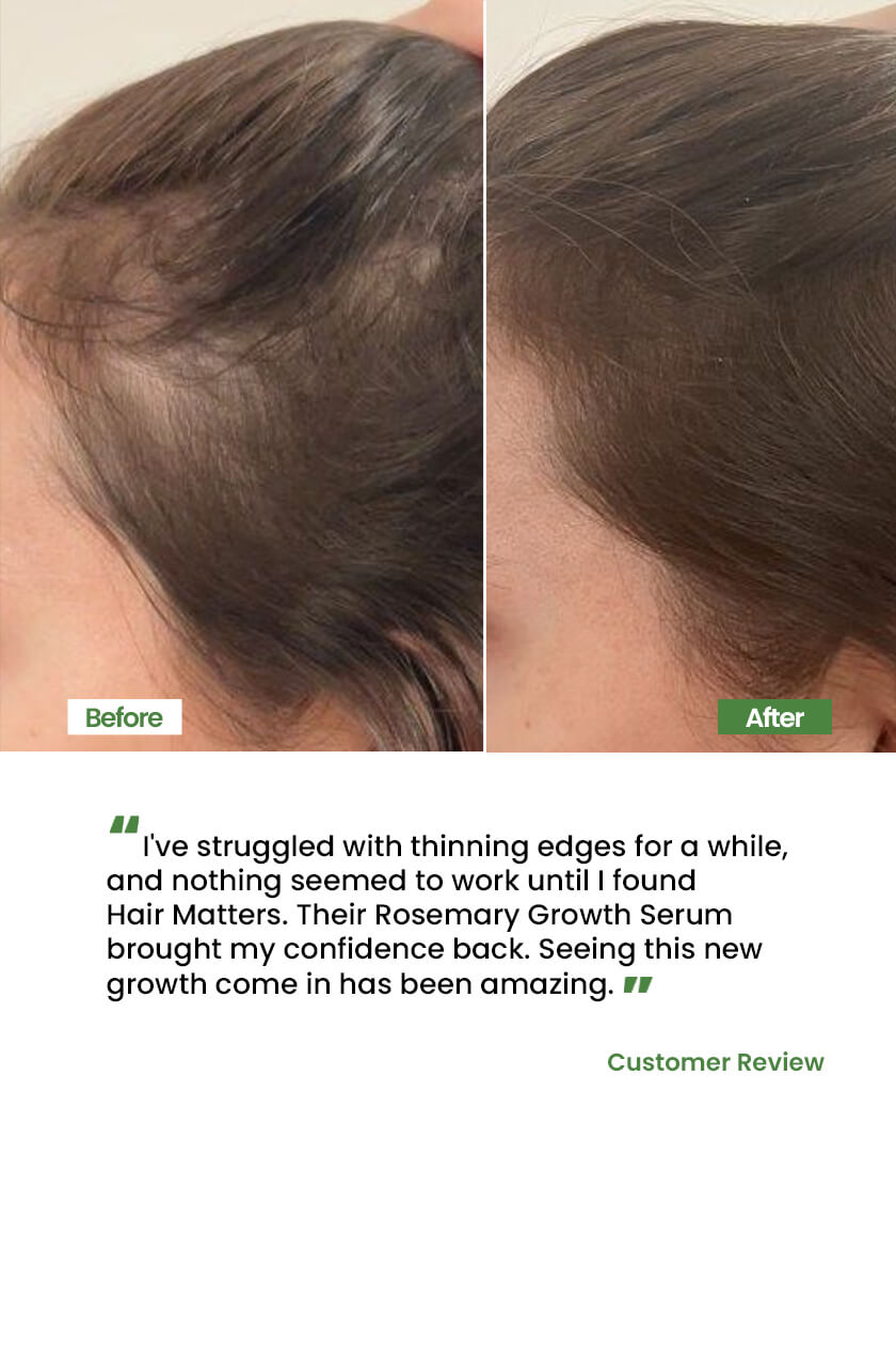 Rosemary Growth Serum for Fast Hair Regrowth